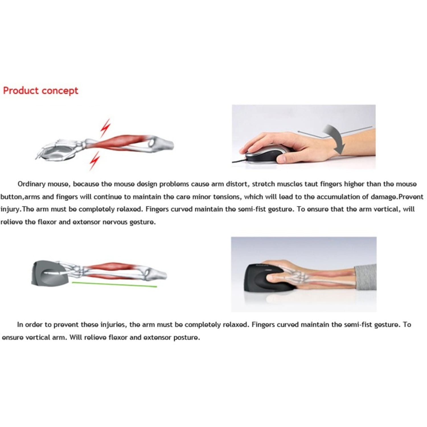 Ergoguys Comfi EM011-BK Wired Ergonomic Mouse - Image 3