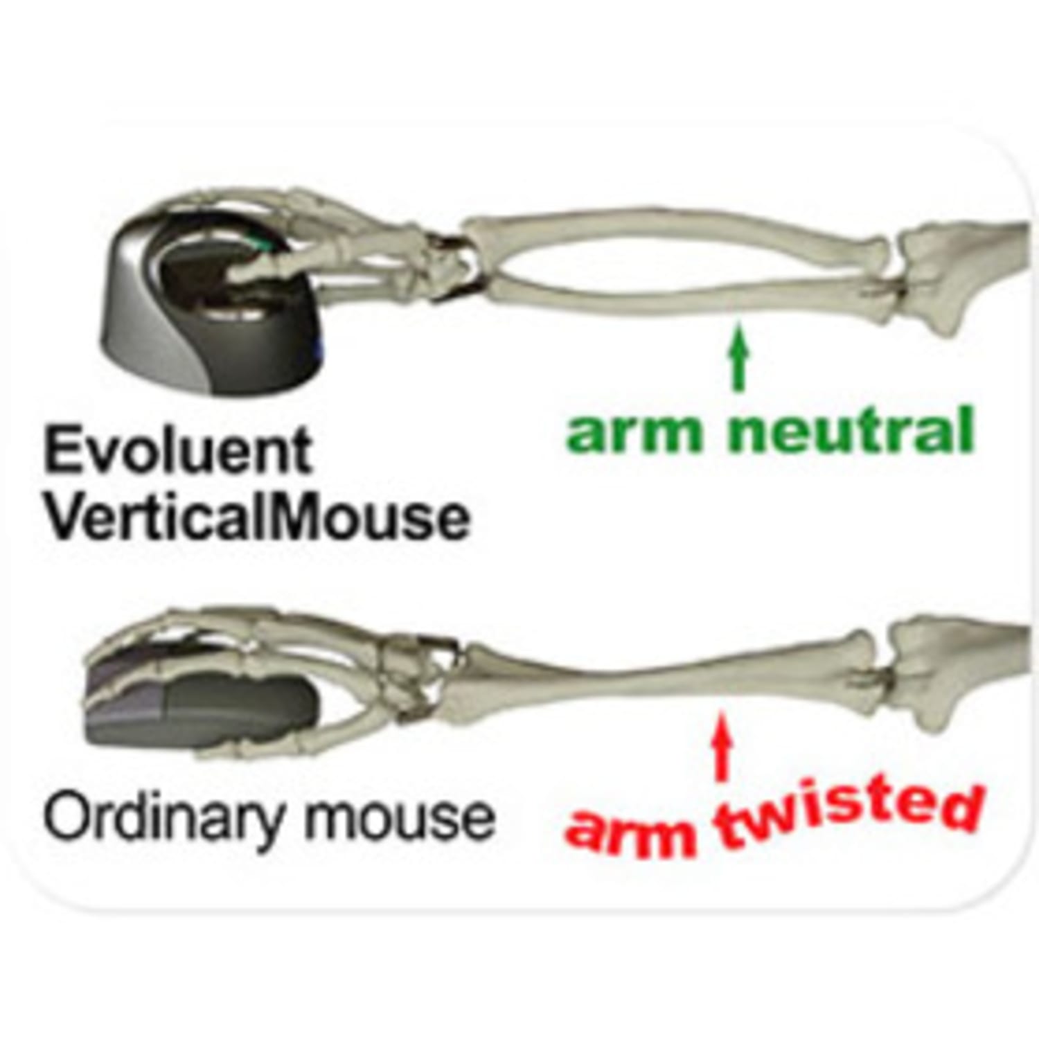 Evoluent VerticalMouse 4 Right Bluetooth Technology (NO DONGLE REQUIRED) - Optical - Wireless - Bluetooth Technology (NO DONGLE REQUIRED) - White - 2600 dpi - Scroll Wheel - 6 Button(s) - Right-handed Only - Image 4
