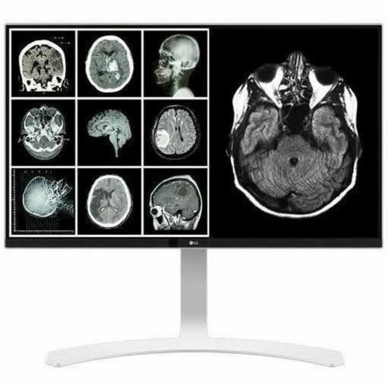 LG 27HJ712C-W 27in Class 4K UHD LCD Monitor - 16:9 - White - TAA Compliant - 27in Viewable - In-plane Switching (IPS) Technology - 27HJ712CW - Image 3